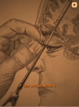 Um prego dentro